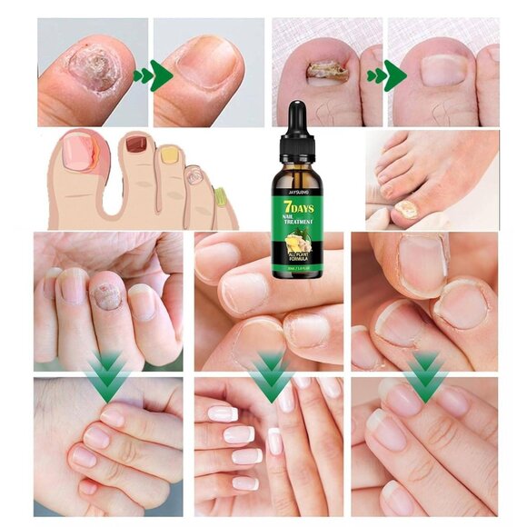 Ginger Nail Treatment Oil –Nail Growth & Cuticle Care (2pcs, 1 fl. oz each) - Picture 6 of 7
